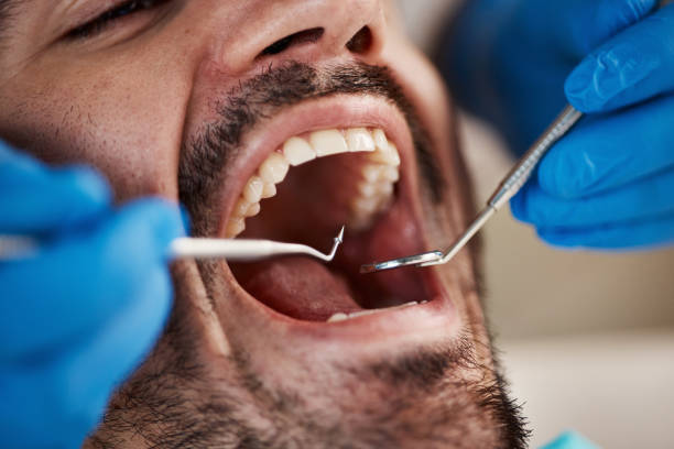 Best Emergency Dental Services Near Me  in Copper Canyon, TX