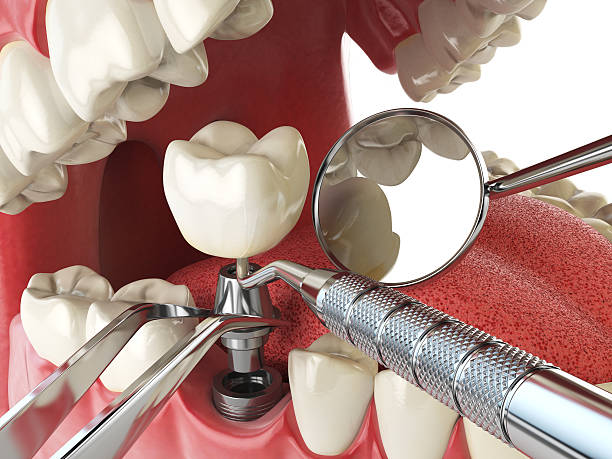 Best Tooth Infection Emergency Dentist  in Copper Canyon, TX